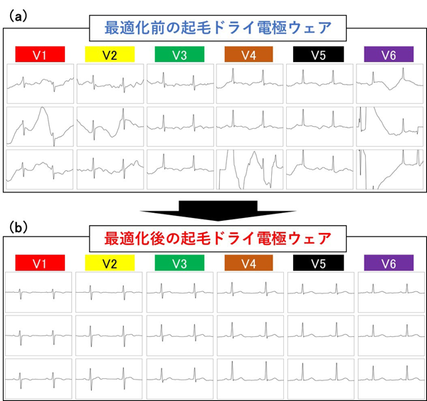 最適化前（a）後（b）の起毛ドライ電極ウェアを用いた胸部誘導の心電図計測結果